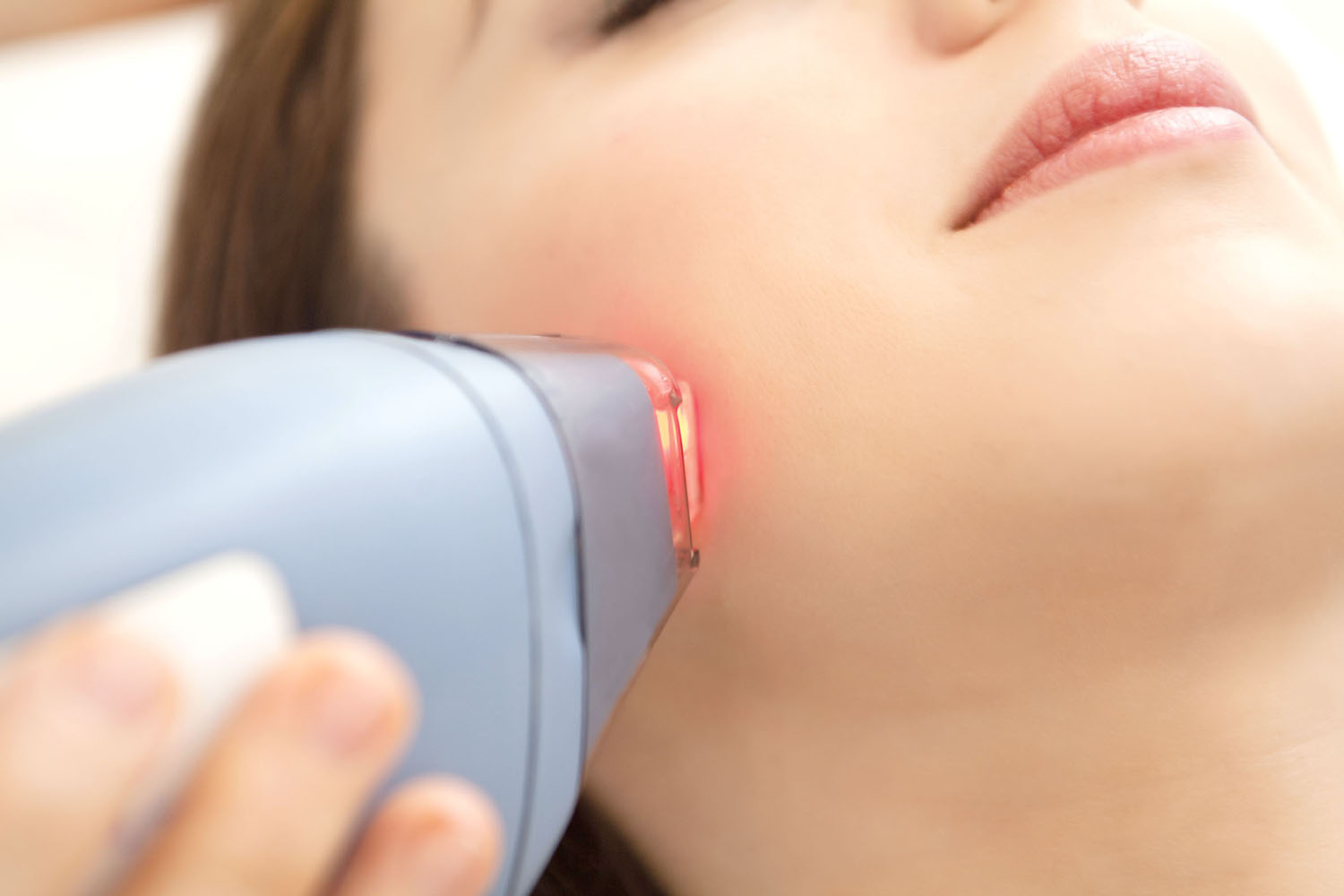 Laser Hair Removal System Facts