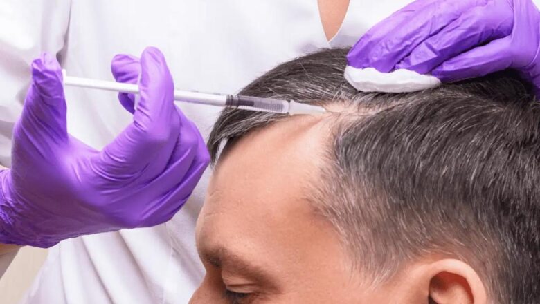 How PRP Hair Restoration Works: A Scientific Breakdown