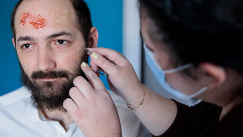 Understanding Modern Scar Treatment: A Comprehensive Guide