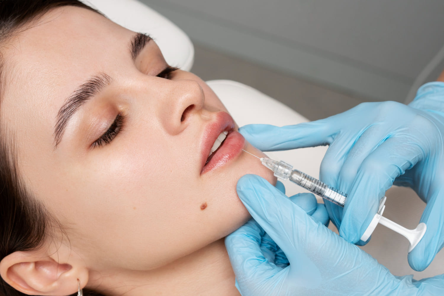 dermal fillers and Botox